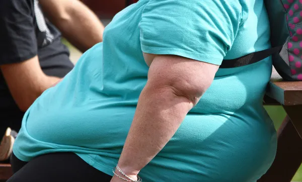 Obesidade-1 Obesidade É Doença? Entenda a Ciência Por Trás da Condição