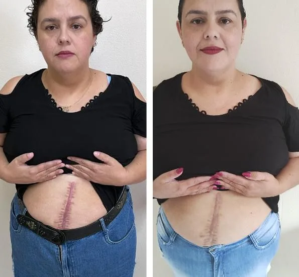 rosa-amazonica-4 Rosa Amazônica: O Segredo para uma Pele Jovem e Radiante Vale a Pena?