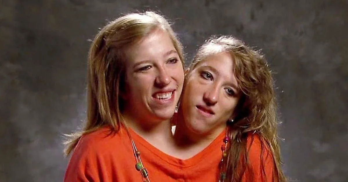 Gêmeas siamesas Abby e Brittany Hensel são vistas novamente com um bebê em Minnesota, alimentando especulações. Entenda o contexto e o casamento de Abby com Josh Bowling.